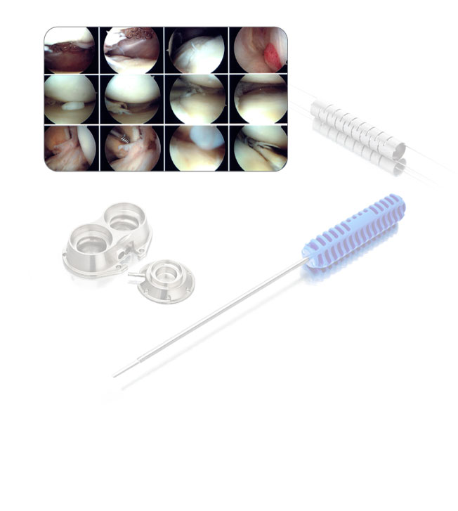 minimally invasive plate osteosynthesis mipo The aim of this study was to examine the results of minimally invasive plate osteosynthesis (mipo) of the femoral shaft fracture in patients where intramedullary nailing is contraindicated and. minimally invasive plate osteosynthesis mipo The aim of this study was to examine the results of minimally invasive plate osteosynthesis (mipo) of the femoral shaft fracture in patients where intramedullary nailing is contraindicated and.