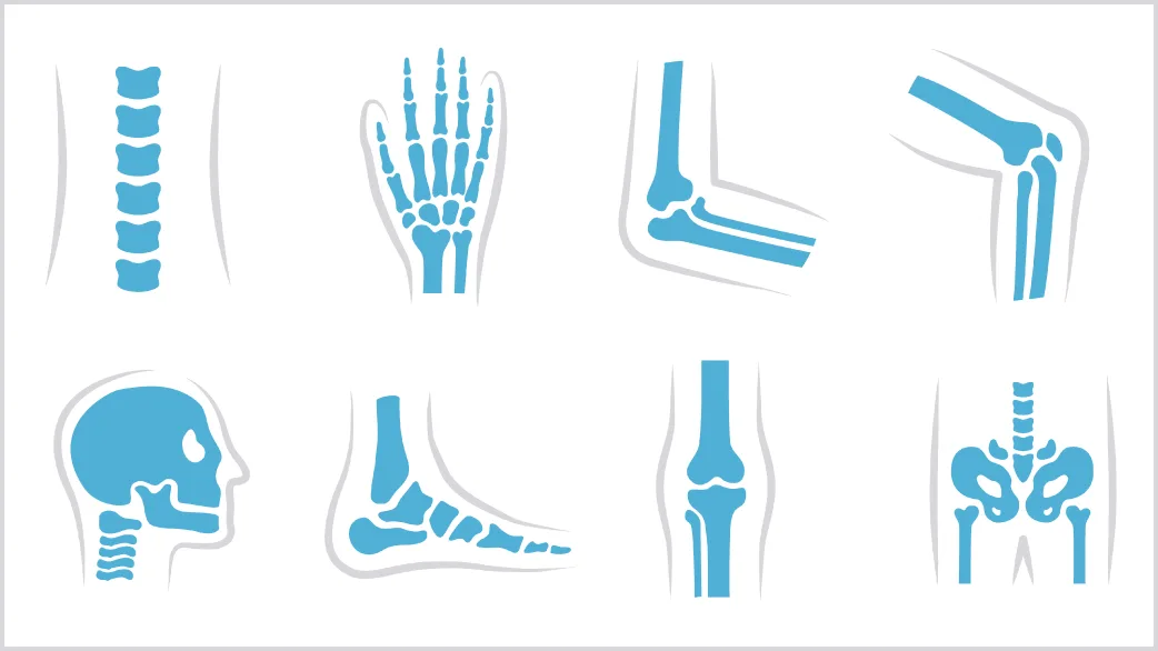 Tegra Medical Helps OEMs Keep Up with Innovations in Advanced Orthopedics