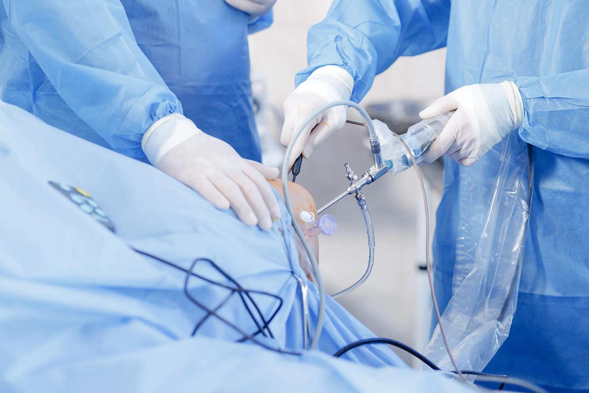 Precision at Scale: Advancing Tissue Shaver Manufacturing with Automation